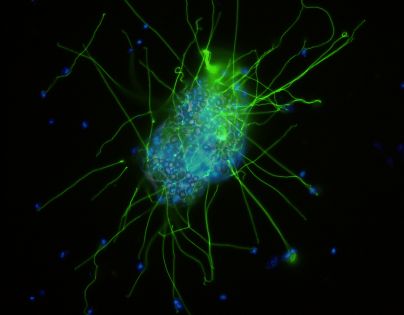 Microsporidies